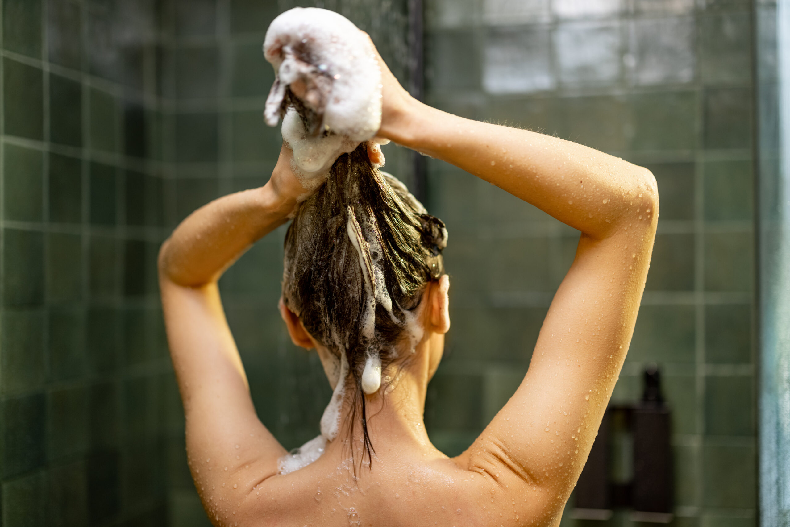Camel Milk Shampoo for Scalp Psoriasis: Natural Healing